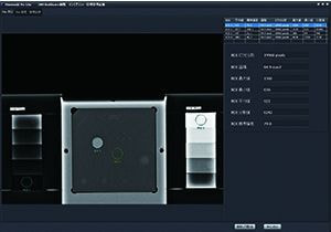繊維組織 ステップ数